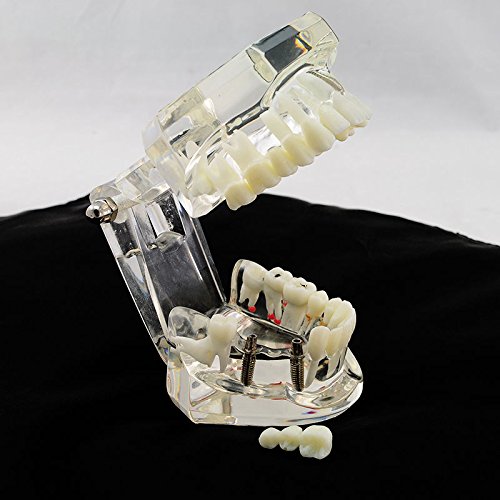5 Dental+Teaching+Typodont+Removable+ZJ+COSM