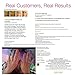 Vitamin C Serum for Face - C Booster With Hyaluronic Acid and Vitamin E - Anti Wrinkle - Anti Aging - Skin Repair For Age Spots and Sun Damage - For Men and Women