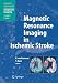 Magnetic Resonance Imaging in Ischemic Stroke (Medical Radiology) by
