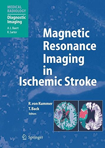 Magnetic Resonance Imaging in Ischemic Stroke (Medical Radiology) by Springer