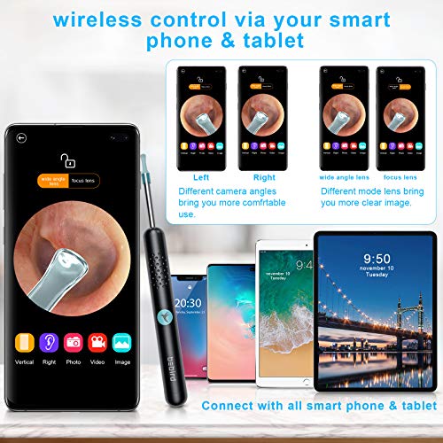 BEBIRD Ear Wax Removal Tool with LED Light, Earwax Removal Endoscope