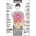Harmful Effects of Alcohol 24" X 36" Laminated Poster