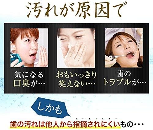 Amazon トゥースmdホワイトex 1個 歯のホワイトニング 歯磨き粉 専用歯ブラシ付き ハミガキ ジェル Tooth Md White Ex ホワイトニング 通販