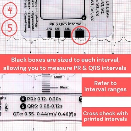 Transparent Ecg Ruler/Card, Transparent Ecg Ruler Card, Ecg/Ekgs Made Easy By Following A 7 Step Plan, Ekg Calipers Measuring Tool, Ideal For Students, Paramedics, Emt'S, Nurses 1PC (A)