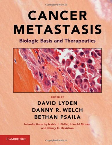 CANCER METASTASIS