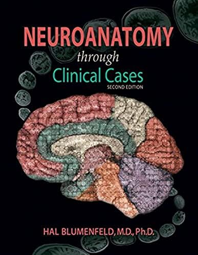 Plum and Posner's Diagnosis of Stupor and Coma (Contemporary