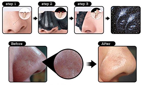 AFY Suction Black Mask Deep Cleansing Blackhead Remover Acne Treatment Facial