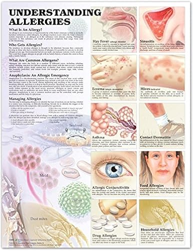 Download Understanding Allergies Anatomical Chart PDF