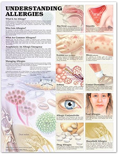 Understanding Allergies Anatomical Chart - //medicalbooks.filipinodoctors.org
