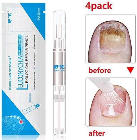 Nail Repair Pen,Nail Fungus Treatment,Remove Discoloration, Prevent Future infection, Repair Brittle Finger Nails and Toe Nails, 4 Count