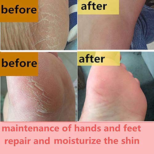 Sunshinehomely Women Hand and Foot Skin Repair, Snail Repair Cream Remove Exfoliating Feet Skin Peeling Calluses Beauty Foot Care
