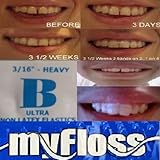 ORTHODONTIC GAP TEETH BANDS 3/16 HEAVY&FLOSS, 1 Pack of 100