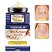 Fungus Treatment Cream,Nail Fungus Cream,Foot Fungus,Fungus Stop,Anti fungal Nail,Restores The Healthy Appearance of Nails Discolored or Damaged by Nail Fungus…
