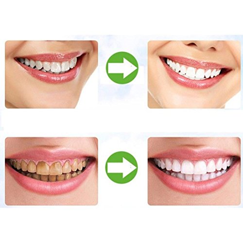 Beauty & Personal Care, Oral Care, Breath Fresheners