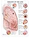 ACC Diseases of The Lung Anatomical Chart