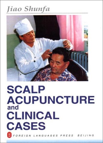 Scalp Acupuncture and Clinical Cases - //medicalbooks.filipinodoctors.org