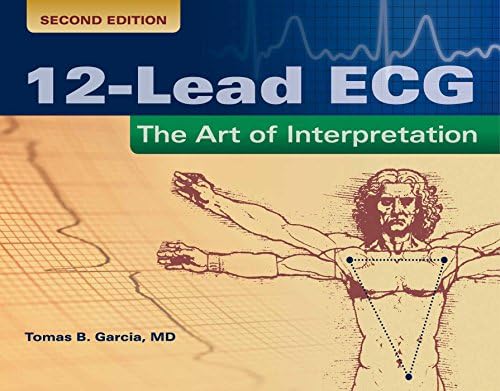 Chou's Electrocardiography in Clinical Practice: Adult and