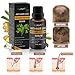 Hair Growth Serum, Hair Treatment, Hair Serum, Hair Loss Treatment, Natural Hair Growth - Anti Hair Loss Promotes Hair Growth, Solution for Hair Thinning and Loss, Hair Regrowth For Men Women