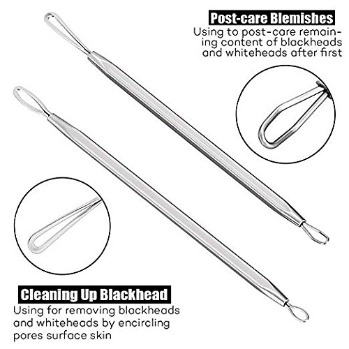 image for ACNE TREATMENT: SCAR REMOVAL & HOW TO GET RID OF PIMPLES WITH HERBAL M