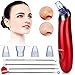 NOEL Blackhead Remover - Pore Vacuum Suction Cleanser & Pimple Popper - Comedone Extractor Acne Removal Cleansing Tool - Includes 5 Heads, 2 Silica Gel Rings, 5 Sponges - Unisex Facial Clean Kit