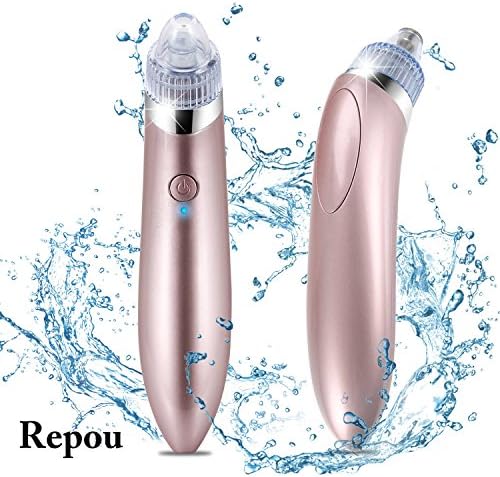 Wotek Blackhead Remover Cleaner Removal Electronic, Facial Nose Skin Cleaner Extraction, Pore Cleaner, Acne Remover, USB Charge (Pink)
