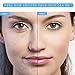 Hyaluronic Acid Serum-100% Pure Hyaluronic Acid Facial Serum Anti Wrinkle Anti Aging Serum for Face-Hydration Hydrating Moisture Serum, Non-greasy,for Dry Skin & Fine Lines(1 OZ)