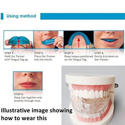 4 High+tech+Dental+Orthodontic+Braces+Straightening