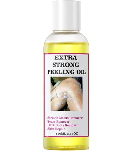 Amazon.com: LHALA Doctor Facial Peeling Solution, 10ml / 0.34 fl