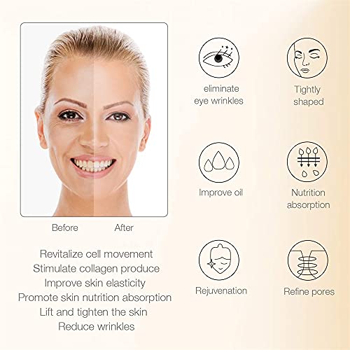 MLAY RF Radio Frequency Skin Tightening Machine for Facial and Body