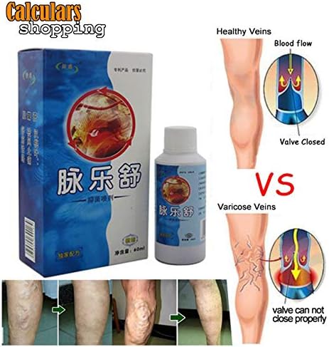 Natural Herbal Medicine Formula Varicose Treatment Vein Spray Relief Vasculitis+