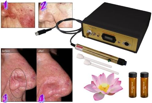DM-9055iDX professional spider vein treatment machine kit for broken capillaries