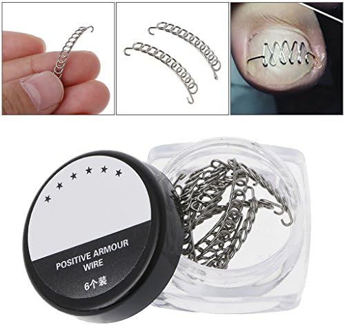 Usdepant Ingrown Toenail Tool Correction Pedicure Wire Fixer Paronychia Recover Tool