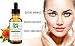 100% Natural Rejuvenating Serum. All Natural Serum For Face, Neck, Chest - Unique Gentle Care - Perfect For All Skin Types - Great Moisturizer & Anti Aging Formula.
