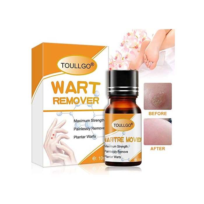 Plantar Wart Remover, Wart Removal, Salicylic Acid Wart Removal, Maximum Strength, Painlessly Remove Plantar Warts…