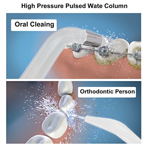 Water Flosser Teeth Cleaner, THZY 2019 Upgraded 600ML Electric Oral Irrigator Water Pick with 7 Interchangeable Nozzles For Braces, Implants, Bridges, Global Voltage Black - Thumbnail 4