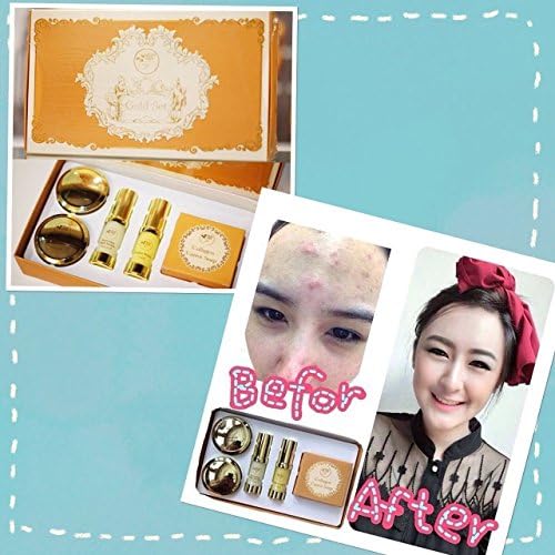12 Sets X Result Within 7days. Freshy Face Gold SET Acne &amp; Blemish Treatments Whitening and Aura Skin.[Get Free Tomato Facial Mask]