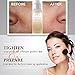 NEW Witch Hazel Rose Scented Primer & Toner to Perfect & Clear Acne-Prone Skin & Tighten Pores with this Astringent, Hydrating and Calming Face Treatment. Travel Size