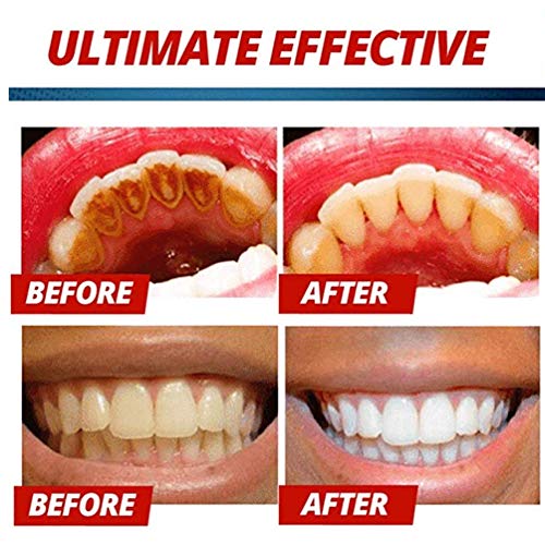 Strengthening Stain Removal Gel Toothpaste Teeth Whitening Toothpaste Fight Bleeding Gums White Toothpaste, Natural, Vegan, Paraben-Free, Anti-Cavity, Pump Packaging (Passion fruit) - Thumbnail 6