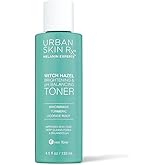 Urban Skin Rx® Witch Hazel Brightening & pH Balancing Toner, Exfoliated & Clarifies Clogged Pores, Improves The Appearance of Uneven Skin Tone, Reduces Redness & Brightens Dull Complexions, 4.5 Fl Oz