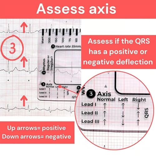 Transparent Ecg Ruler/Card, Transparent Ecg Ruler Card, Ecg/Ekgs Made Easy By Following A 7 Step Plan, Ekg Calipers Measuring Tool, Ideal For Students, Paramedics, Emt'S, Nurses 1PC (A)