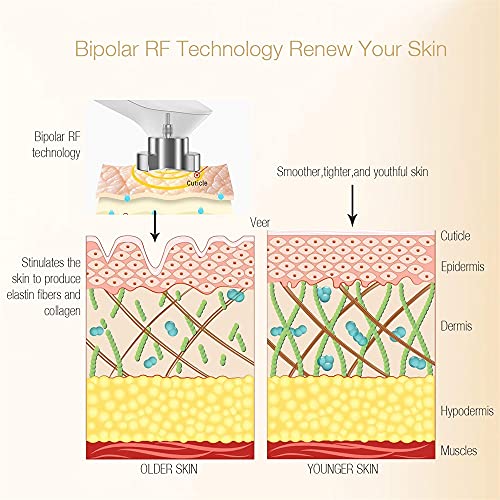 MLAY RF Radio Frequency Skin Tightening Machine for Facial and Body