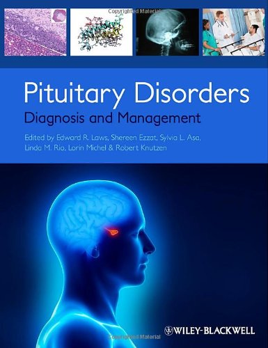 Pituitary Disorders: Diagnosis and Management
