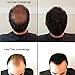 Samson Hair Fiber Refill 100 Grams For Hair Loss Concealing USA Suitable for all brands (Dark Brown)