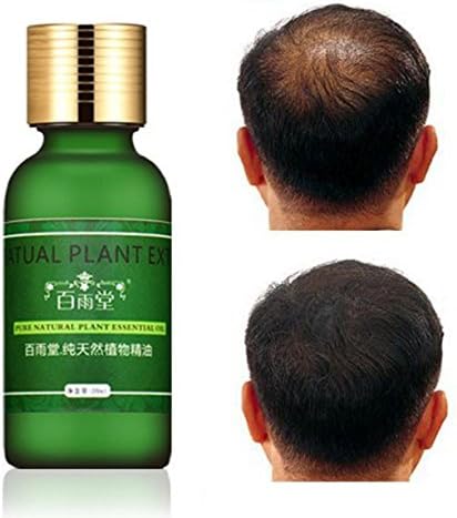 Natural Plant Extract Rapid Hair Growth Essence Essential Oil Liquid Ginseng Ginger Herbal Pure by Saturday24