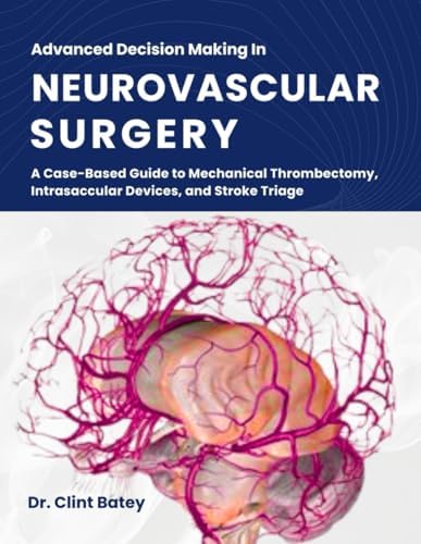 健康・医学 Decision Making in Neurovascular Disease Decision Making in Neurovascular Disease: 9781684200573: Medicine