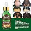 Hair-Growth-SerumHair-Loss-Hair-Thinning-TreatmentHair-SerumStimulates-New-Hair-Growth-Promotes-Thicker-Fuller-and-Faster-Growing-Hair Hair Growth Serum, Hair Loss &Hair Thinning Treatment, Hair Serum, Stimulates New Hair Growth, Promotes Thicker, Fuller…