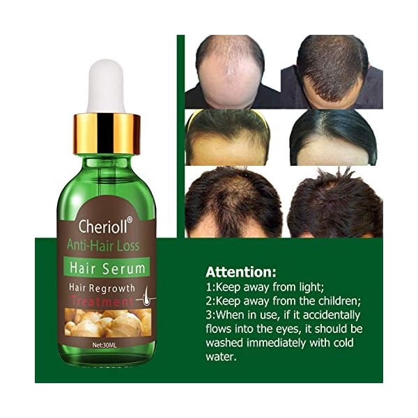Hair-Growth-SerumHair-Loss-Hair-Thinning-TreatmentHair-SerumStimulates-New-Hair-Growth-Promotes-Thicker-Fuller-and-Faster-Growing-Hair Hair Growth Serum, Hair Loss &Hair Thinning Treatment, Hair Serum, Stimulates New Hair Growth, Promotes Thicker, Fuller…