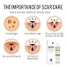 Crocodile Repair Face Serum for Acne Scars, Anti-Aging - Treats Acne, Wrinkles, Stretch Marks - Lightens Old Scars, Removes New Scars - for Men and Women
