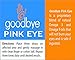 Goodbye Pink Eye – an Effective Treatment for a Natural and Organic Relief of The Symptoms of Conjunctivitis