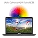 ASUS X751NA-DS21Q  X-Series X751NA-D21Q 17.3